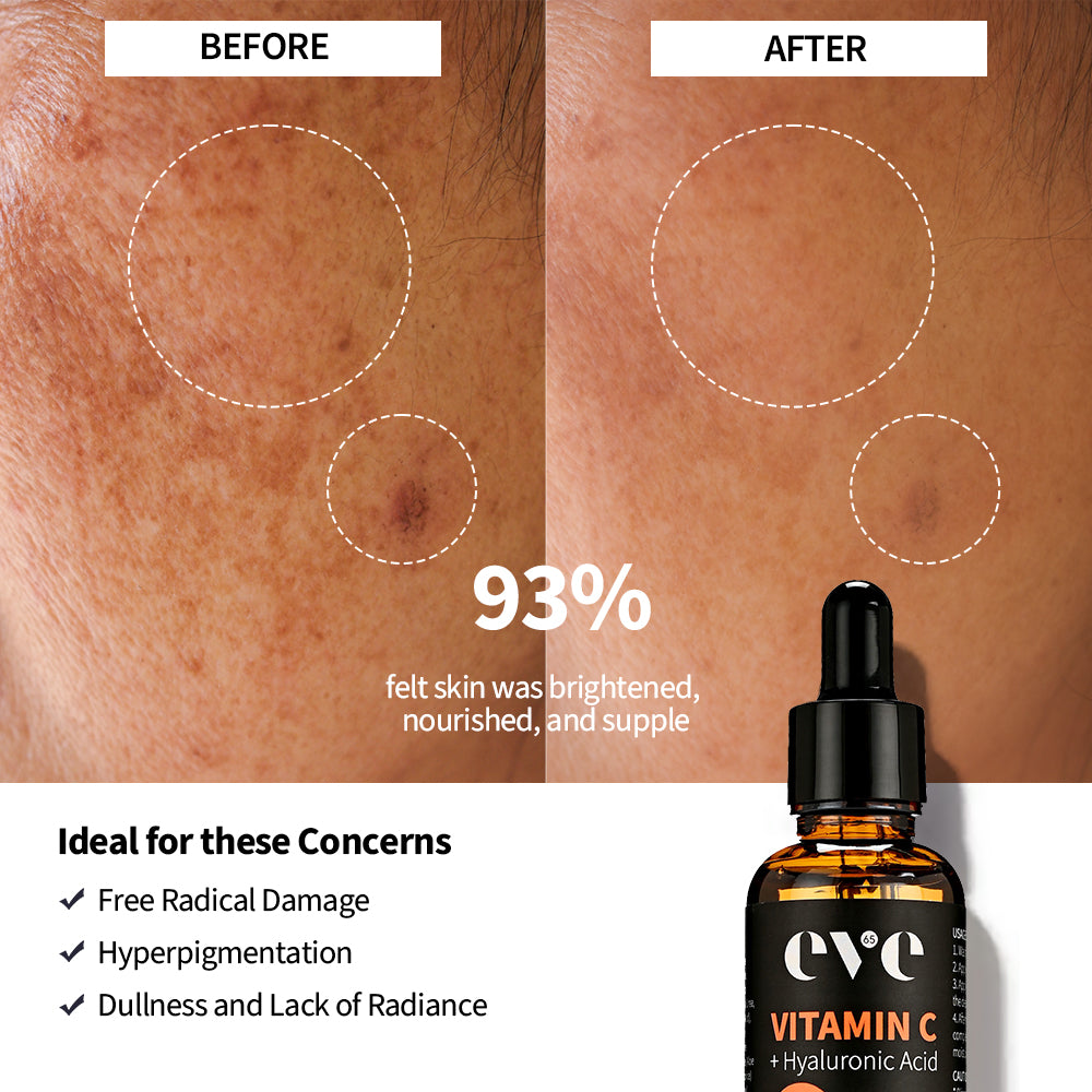 Vitamin C + Hyaluronic Acid Serum